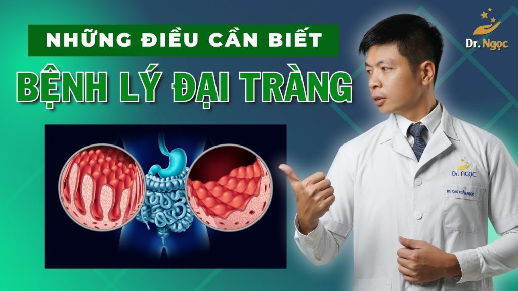 Đại tràng